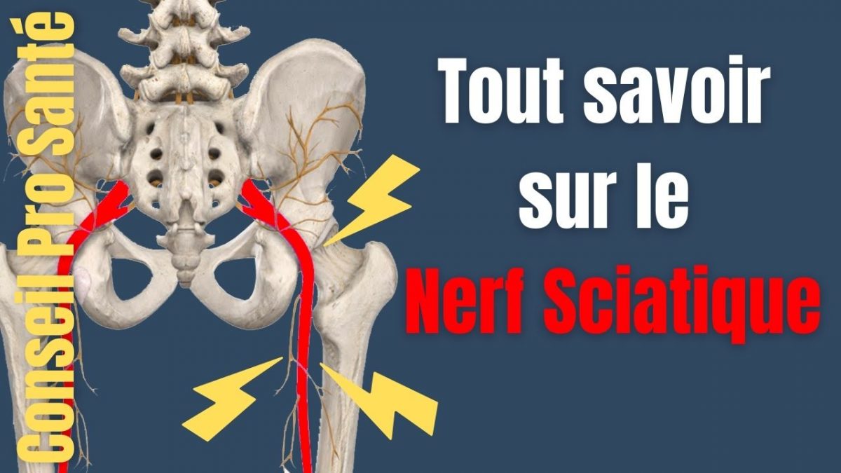 Le nerf sciatique : trajet et anatomie