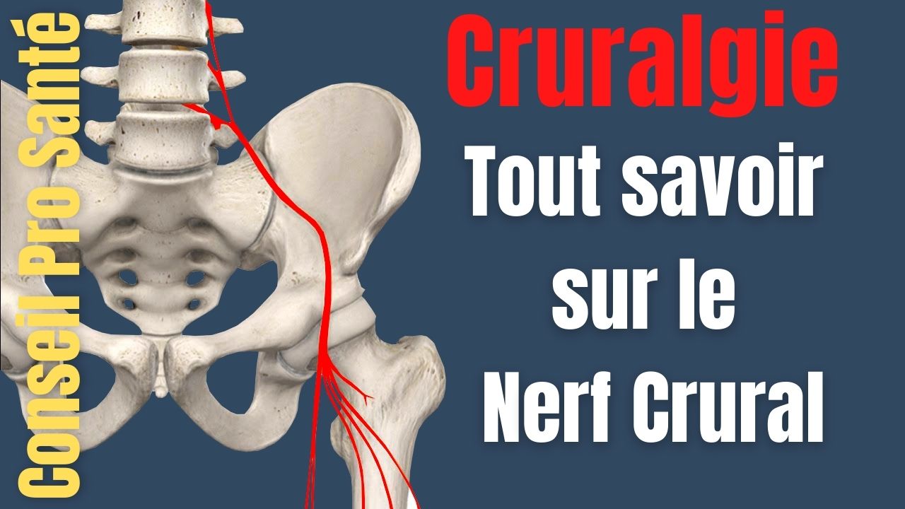 Cruralgie - Qu'est ce que le nerf crural et quel est son trajet ...