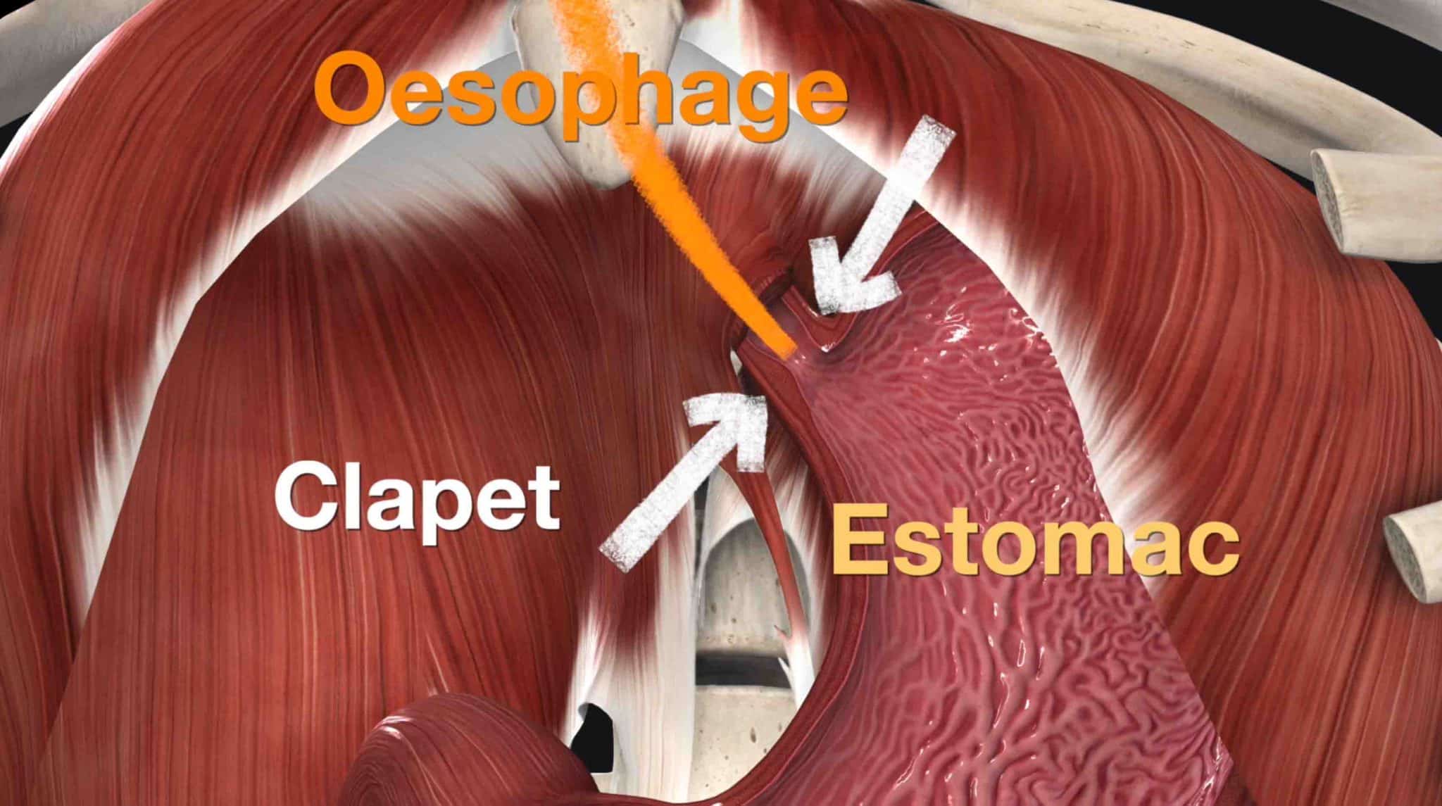 STOP aux Reflux gastriques et Remontée acide 3 Exercices à faire chez soi